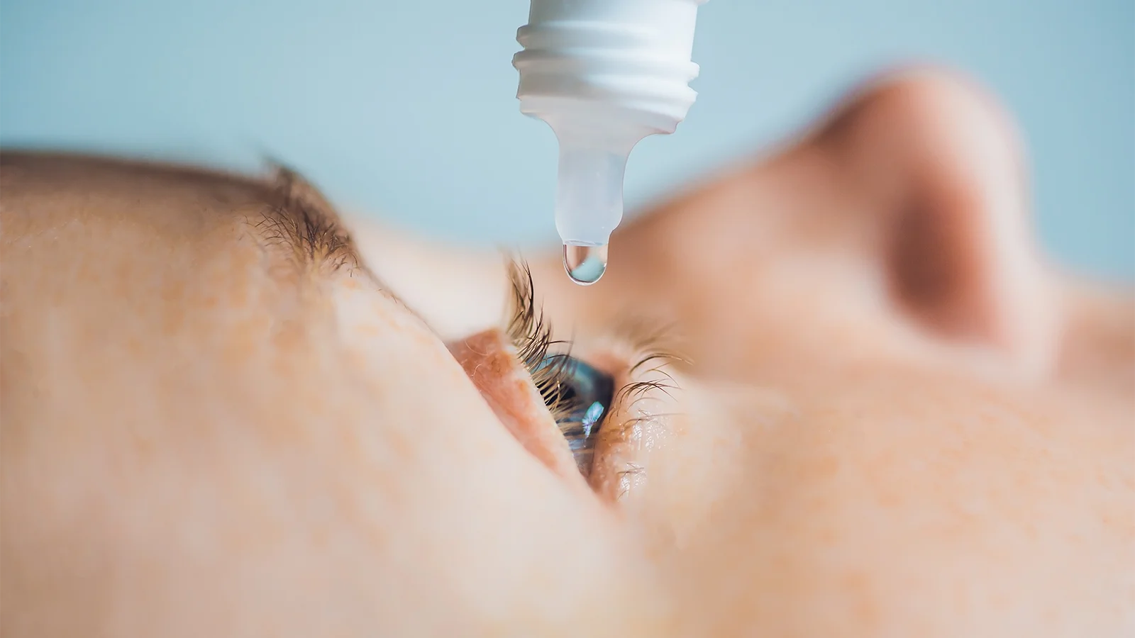 How to Stop Rubbing Your Eyes